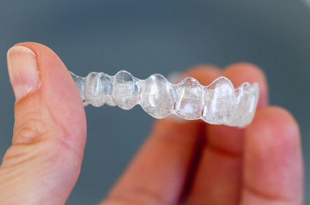 Image of a hand holding a tray of clear braces.