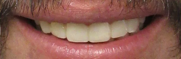 After image