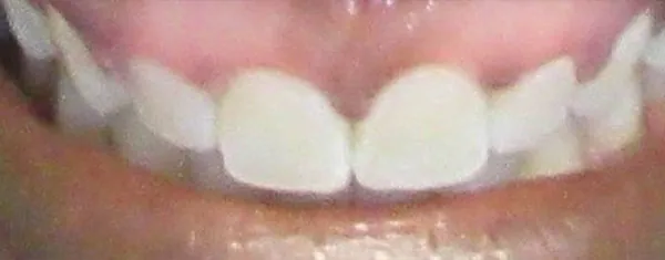 After image