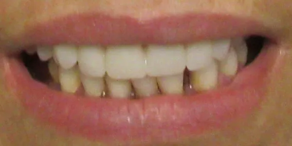 After image