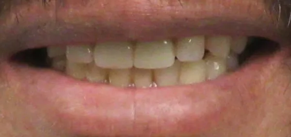 After image