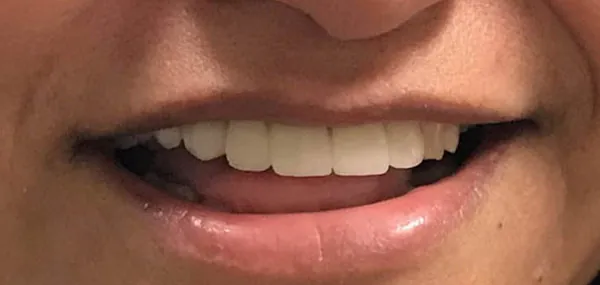 After image
