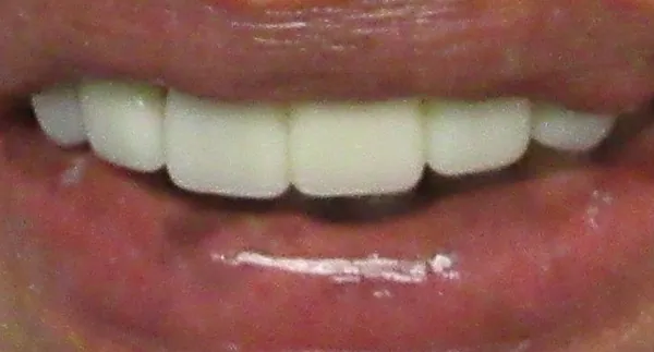 After image