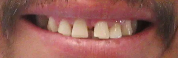 Before image