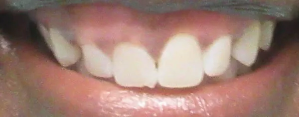 Before image