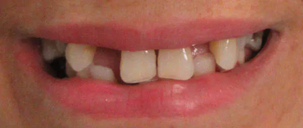 Before image