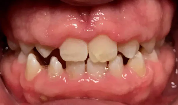 Before image