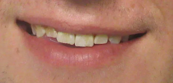 Before image